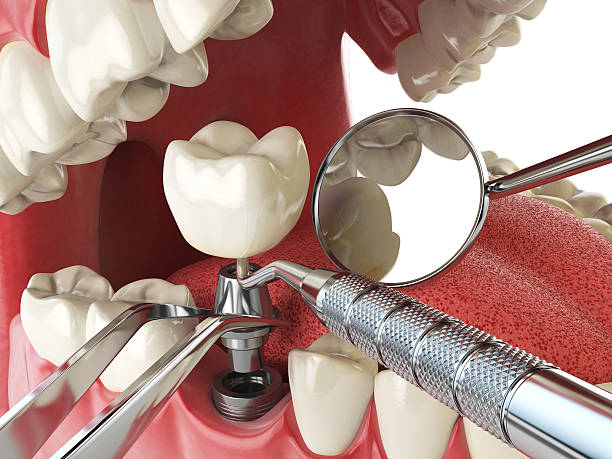 Best Emergency Treatment for Toothache in Theodore, AL